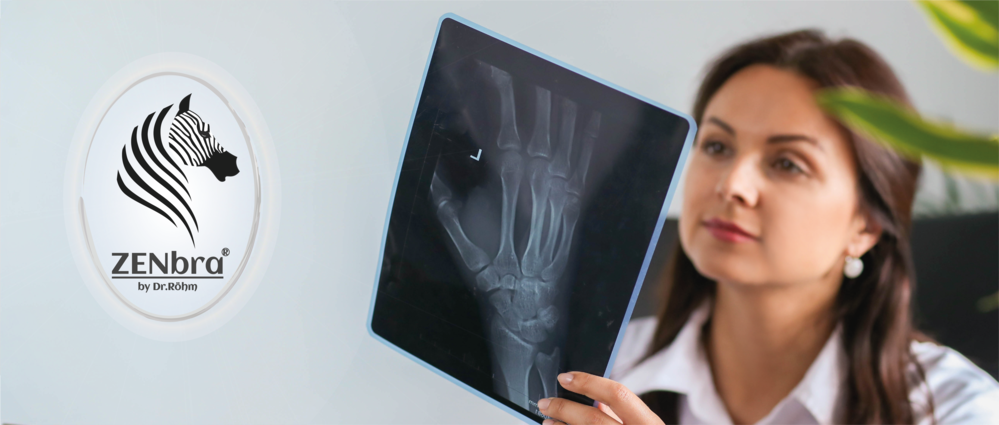 Arthrose 1